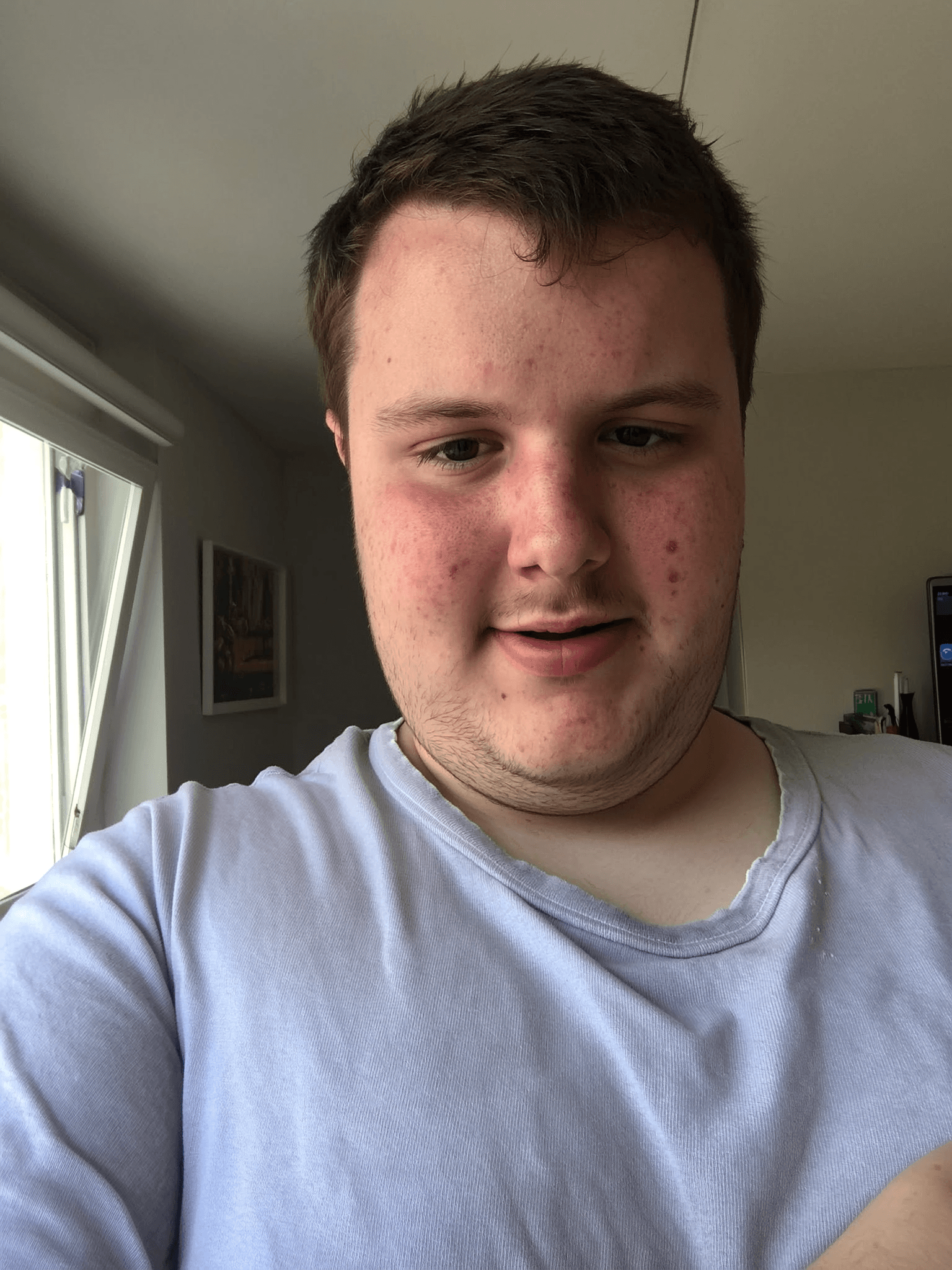 Before transformation